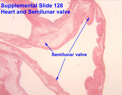 Atrioventricular Valve Histology